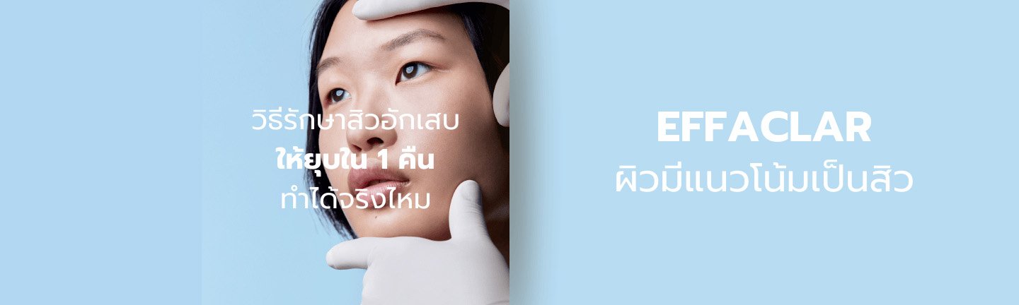 รักษาสิว