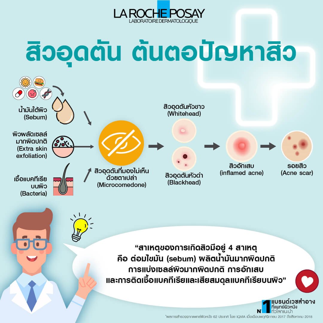  HOW TO จบปัญหาสิวด้วย Effaclar Serum

