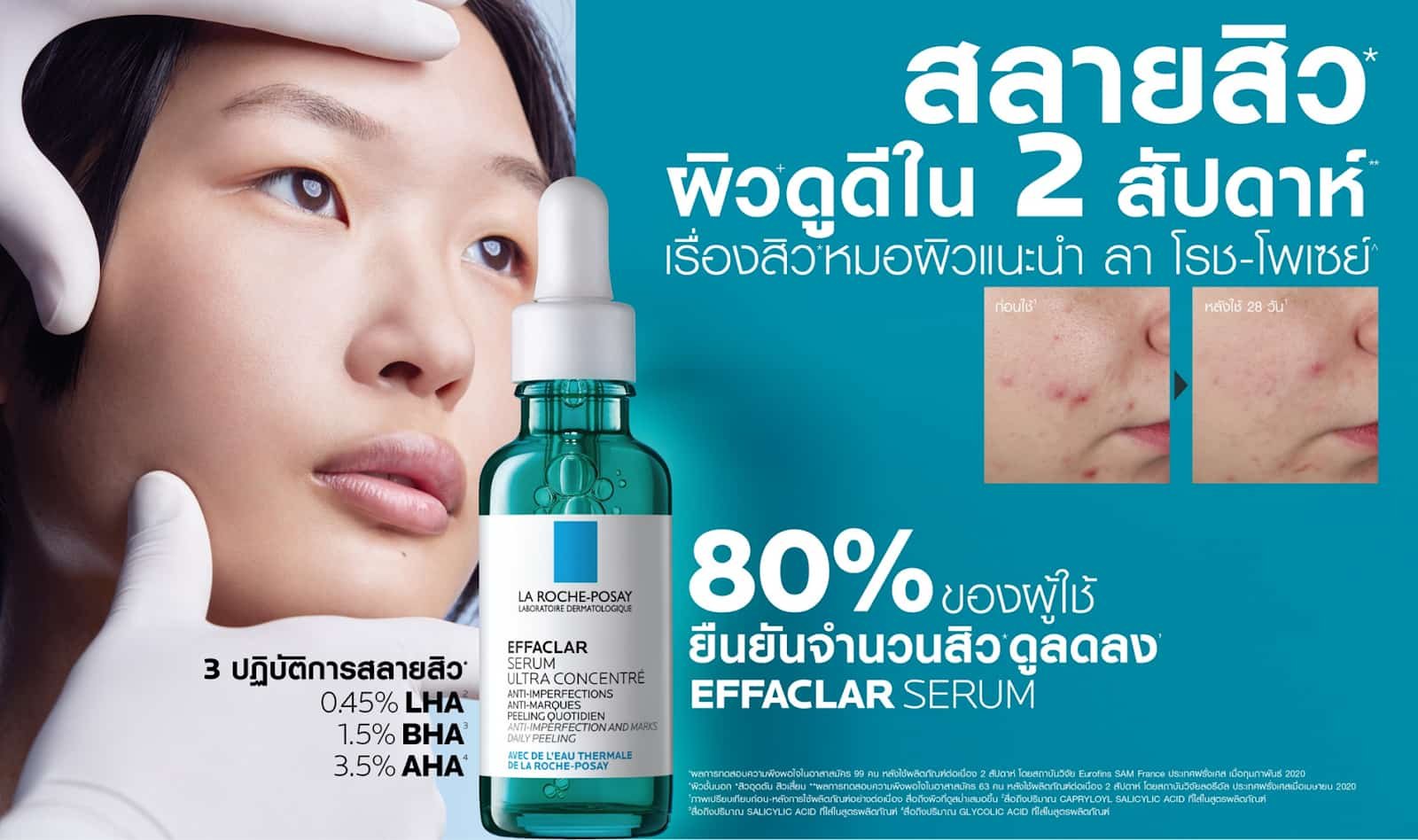เซรั่มลดสิว สลายสิว
