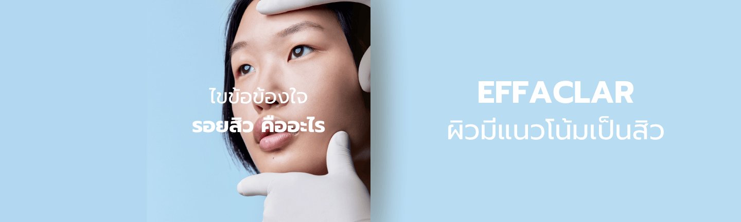 ครีมลดรอยสิว