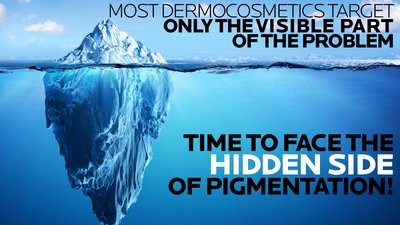 สาเหตุของการเกิดจุดด่างดำ