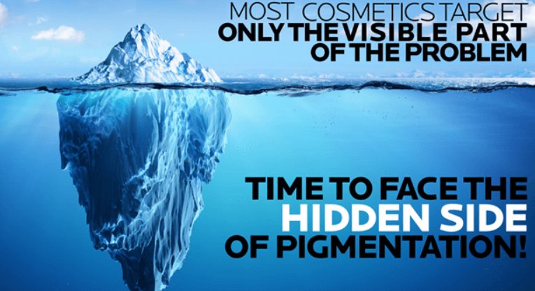 จุดด่างดำ