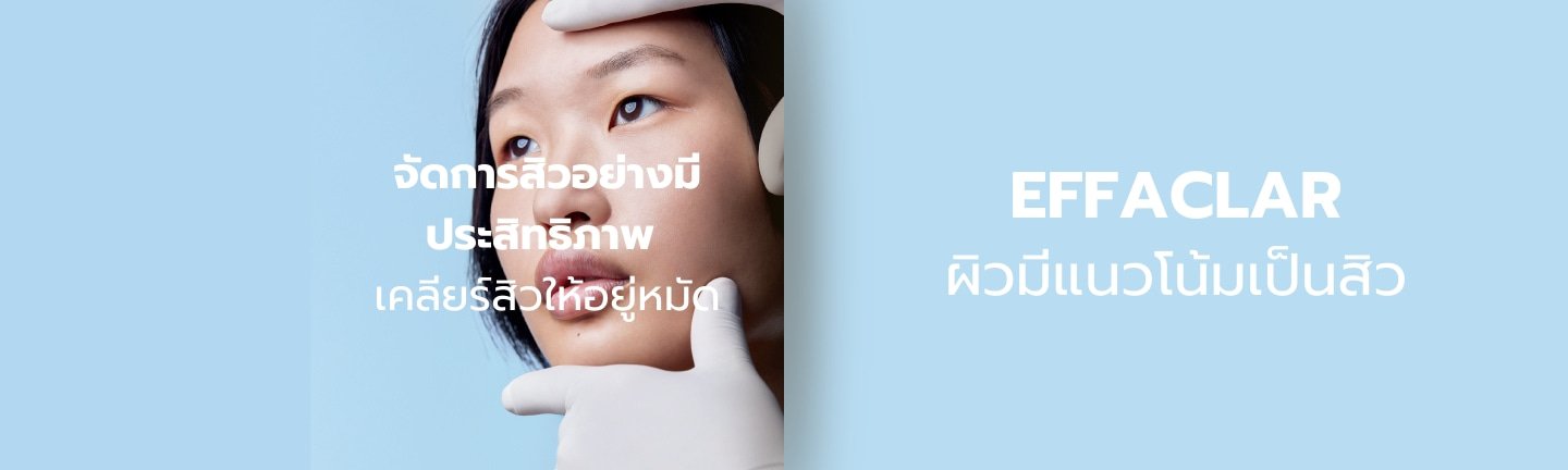 สิวอุดตัน