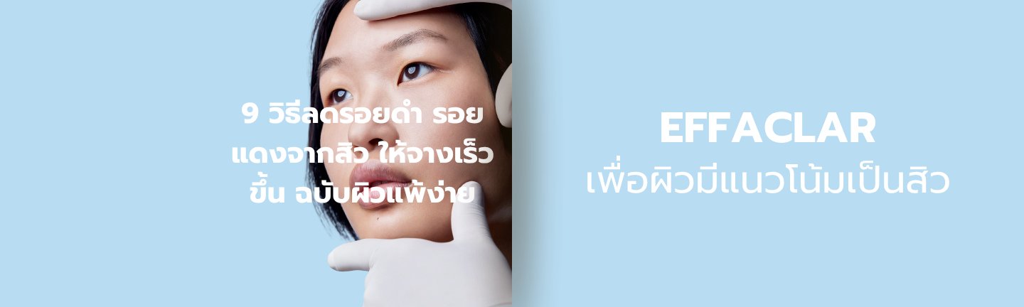 วิธีลดรอยดำจากสิว La Roche-Posay